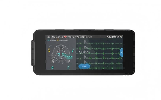 The Advancements of Modern ECG Machine in Hospital Telemetry Monitoring Systems