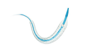 Five Misunderstandings of Coronary Heart Disease Stenting