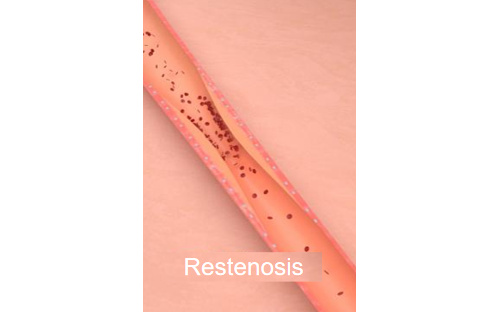 classswiperwrapper forview styletransform translate3d0px, 0px, 0px transitionduration 0ms Stent Rest...